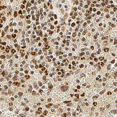 Immunohistochemical Staining of IRE1 alpha in Paraffin Embedded Human Spleen